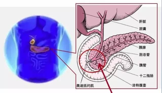 胰腺炎绝对禁用家传骨方特效药酒治疗腰颈椎间盘突出和骨质增生